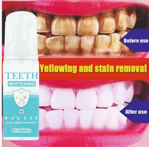 30644 teeth whitening confidence