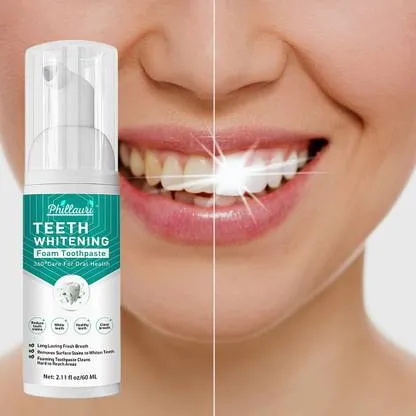 30644 teeth whitening results