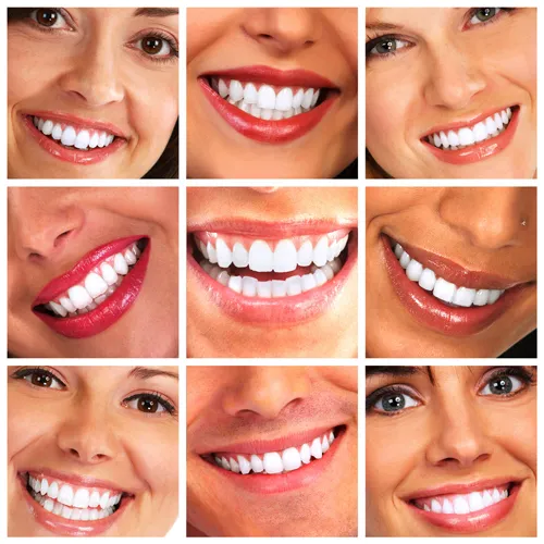 30647 professional tooth whitening