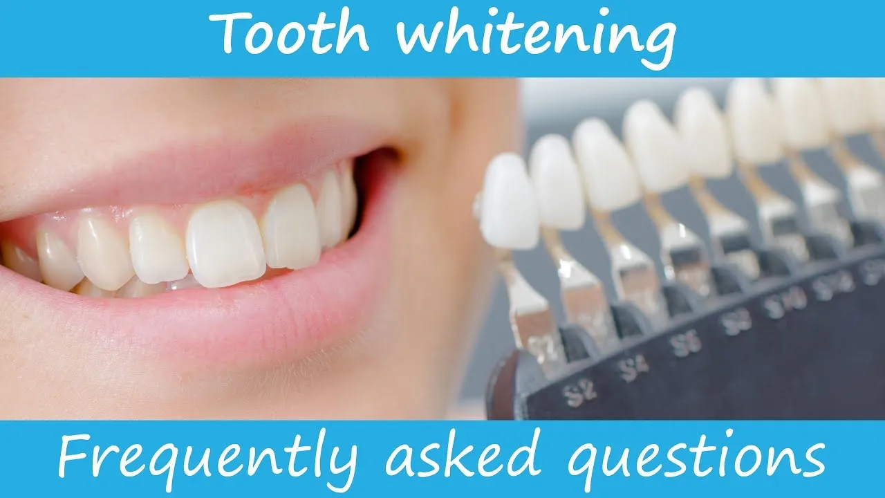 30648 teeth whitening candidates