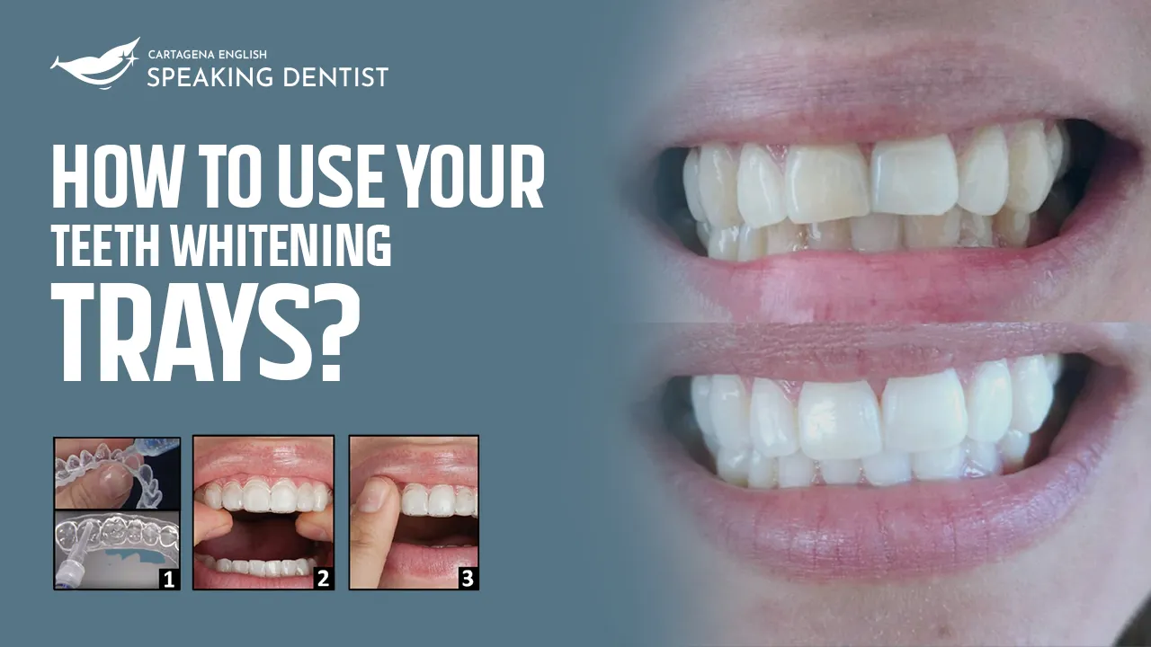 30650 teeth sensitivity