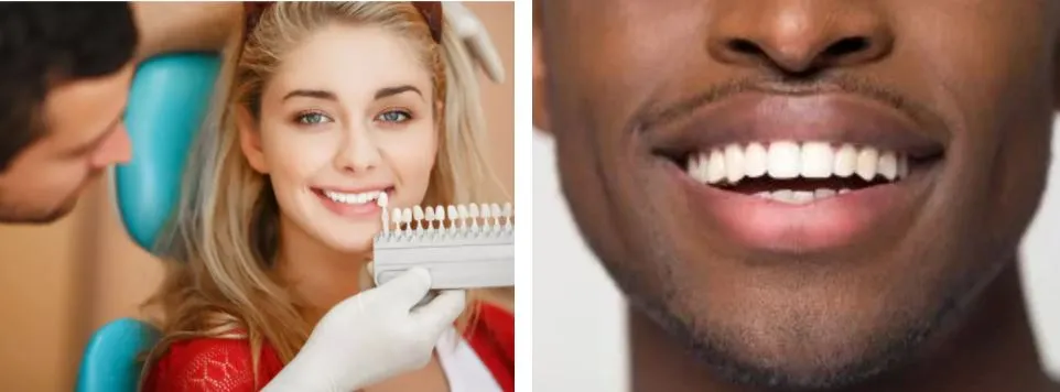 30651 tempe dentist teeth whitening