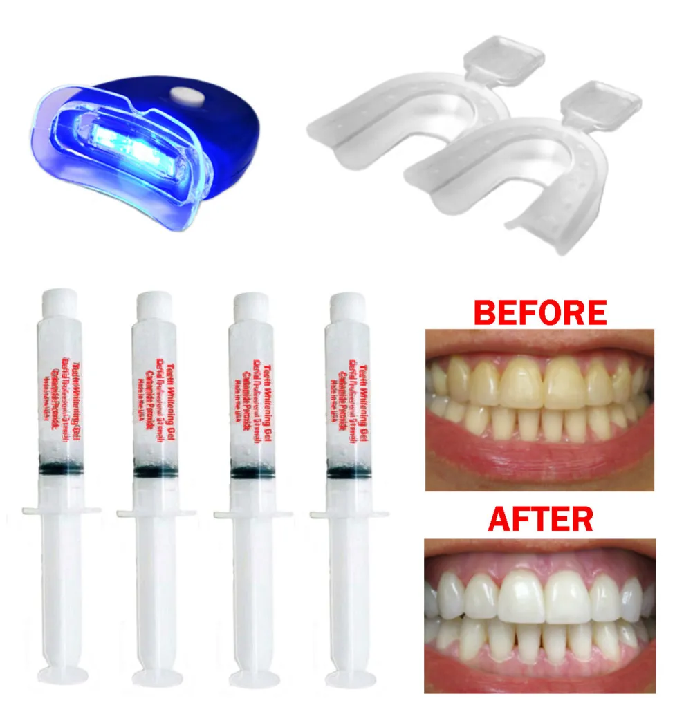 30652 teeth whitening results