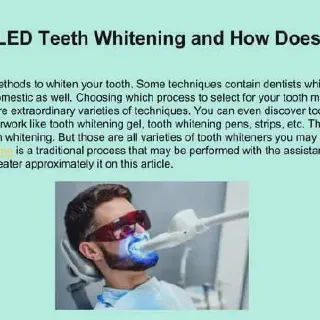 /img/30653-teeth-whitening-results.webp